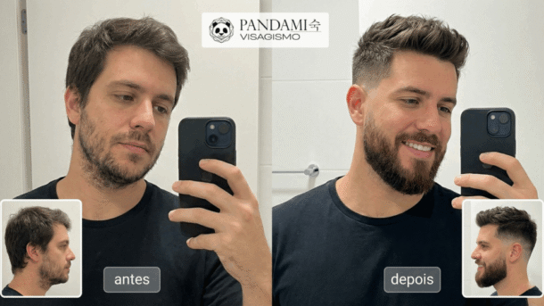 Antes e depois: o que realmente muda?